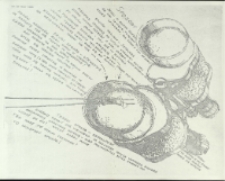 Wielkoludy - program [Dokument życia społecznego]